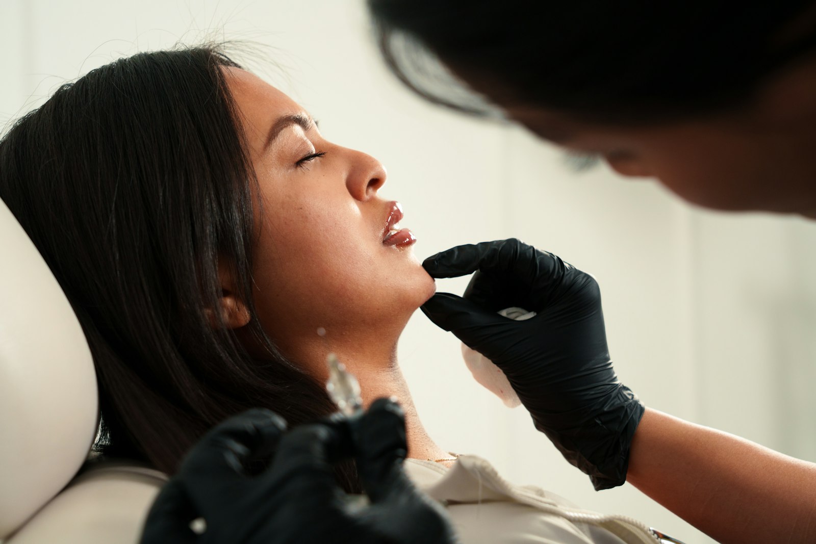 Jawline and chin contouring filler being injected on patient in Maldives