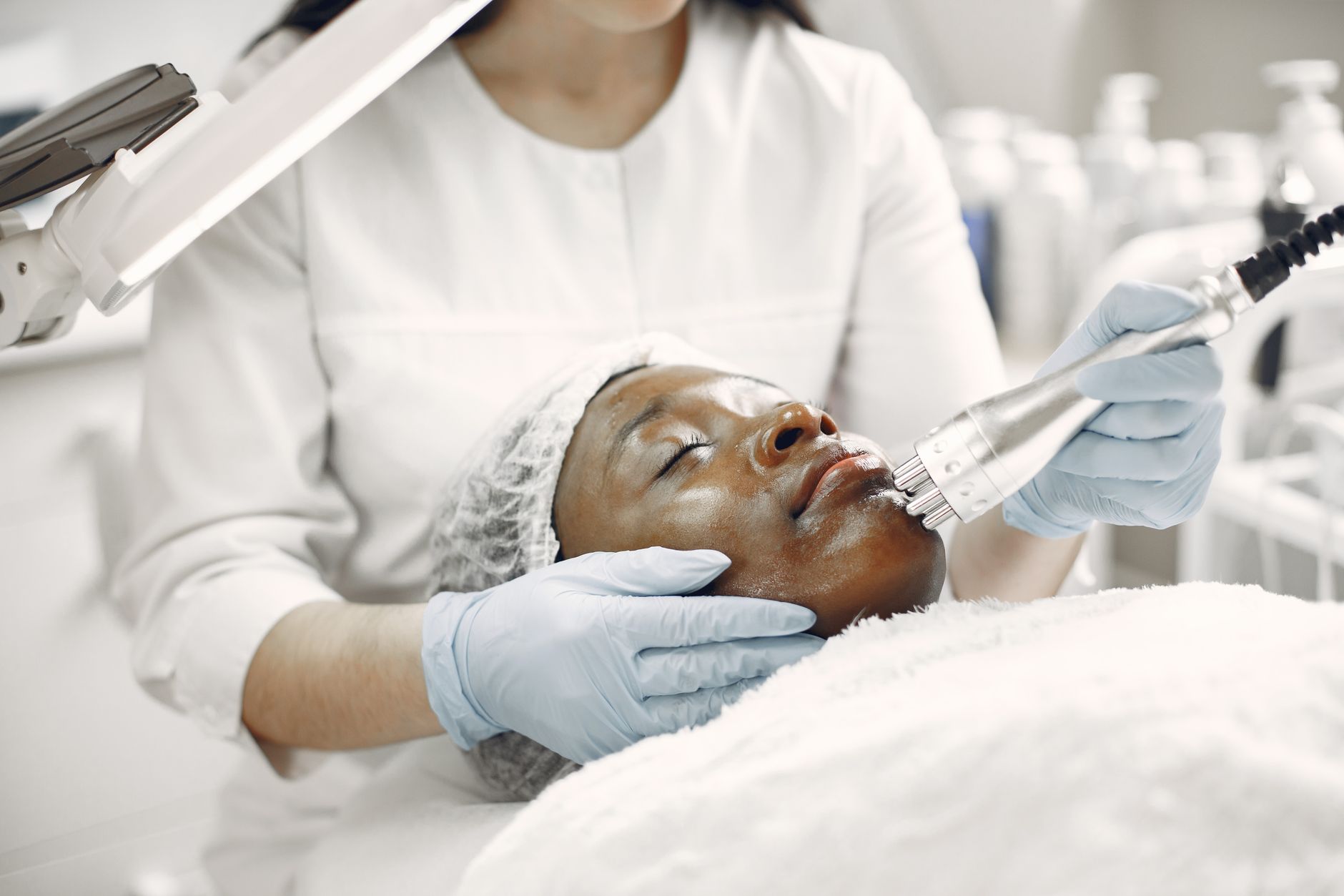 Laser treatment for pigmentation and melasma being performed on patient in Maldives