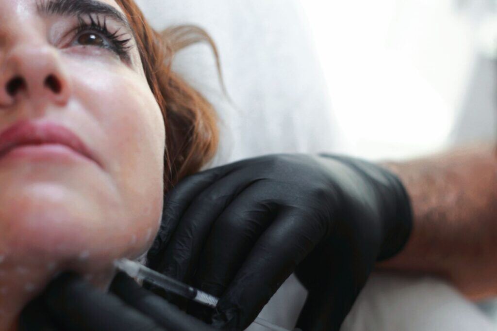 Dermal Fillers treatment, Dr. Alaa Zidan clinic, Maldives