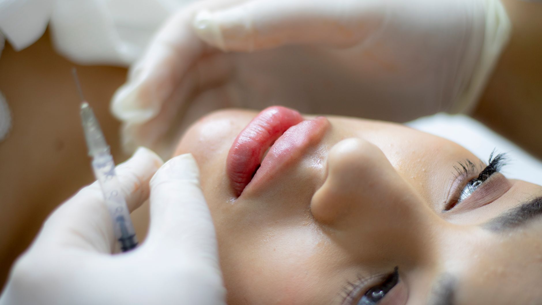Natural Lip Filler in the Maldives: Hydrated, Not Overdone