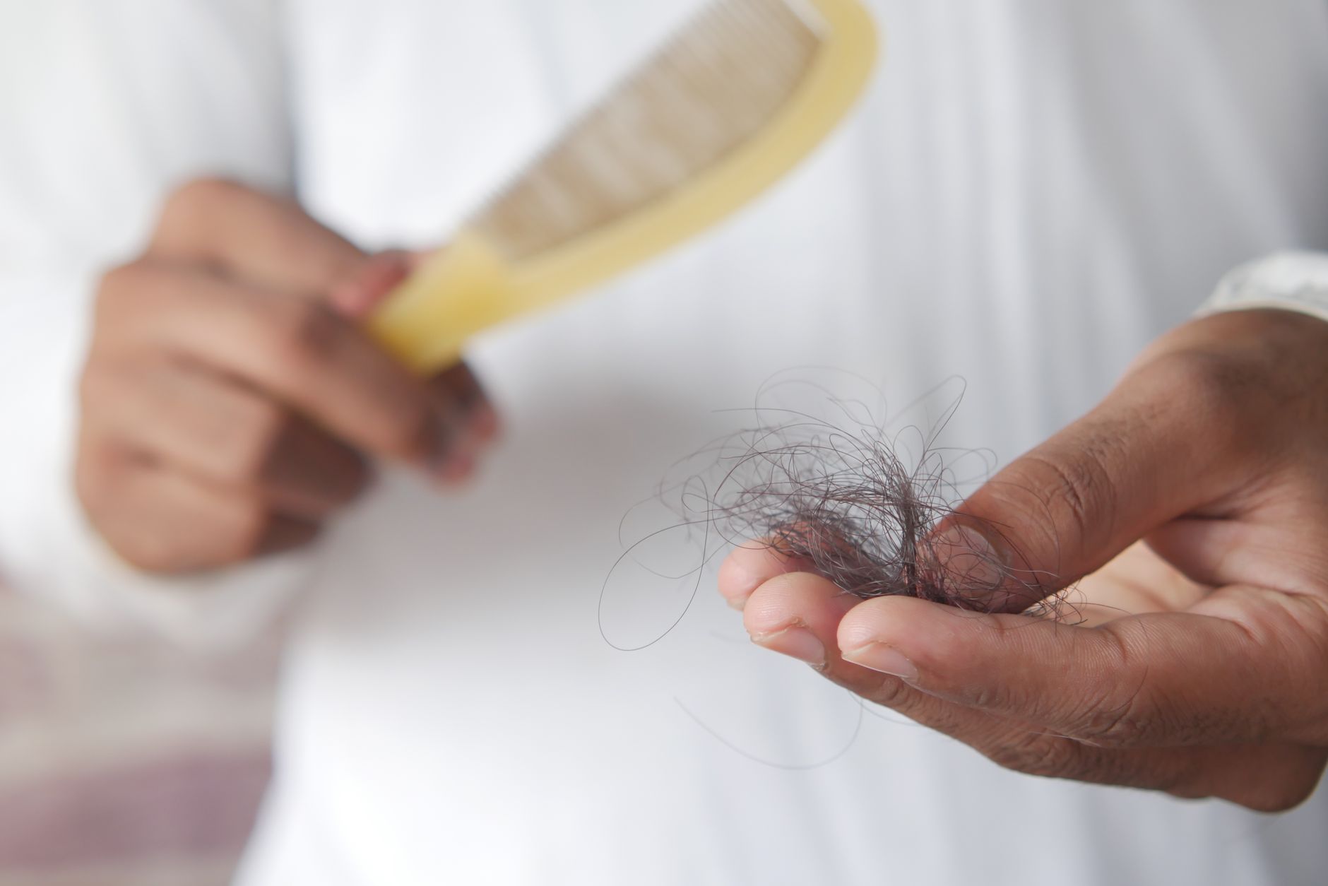 Exosomes for Hair Loss in the Maldives: A New Generation of Regenerative Care