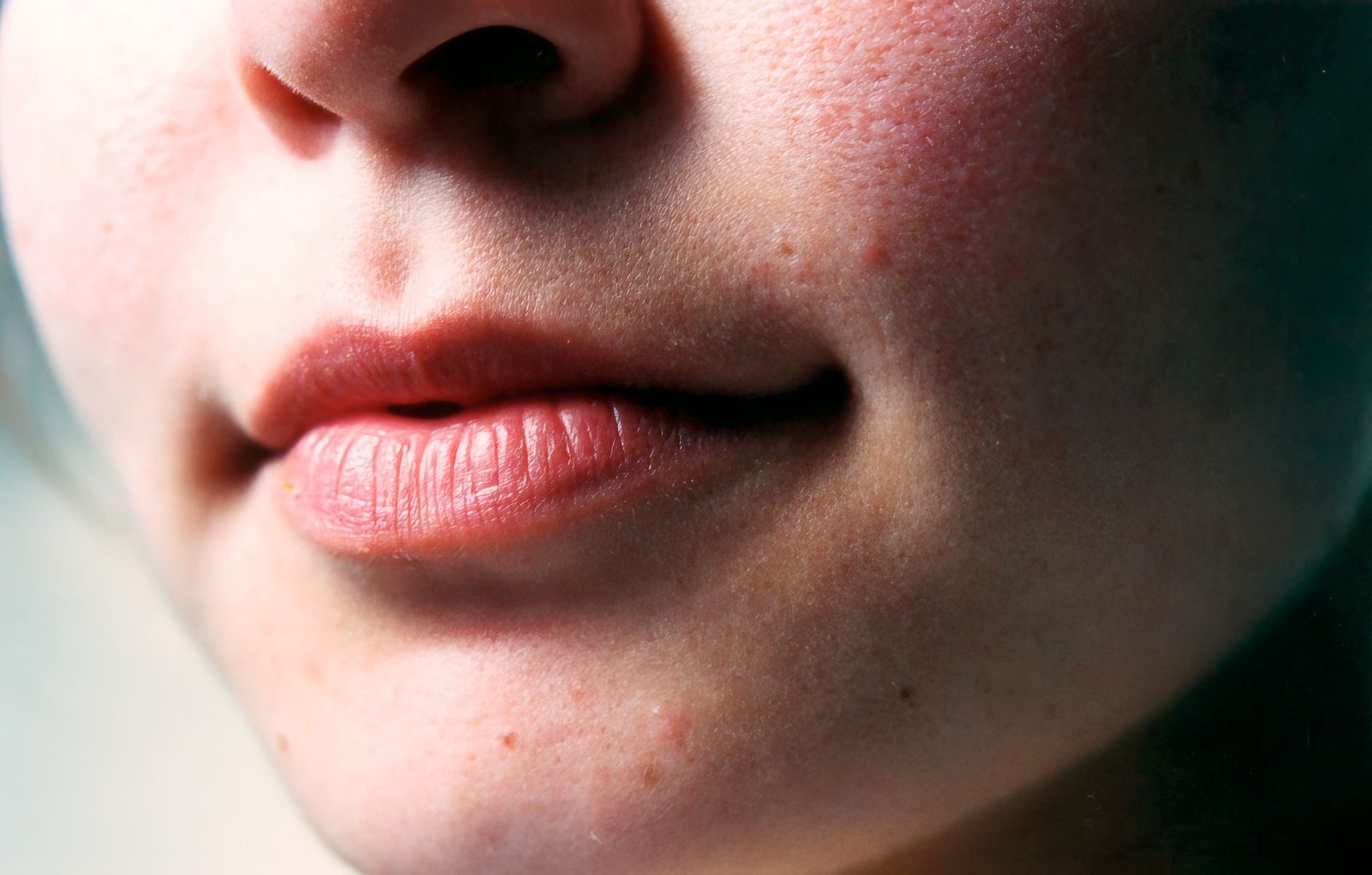 Lip Filler Aftercare: What to Do and Avoid