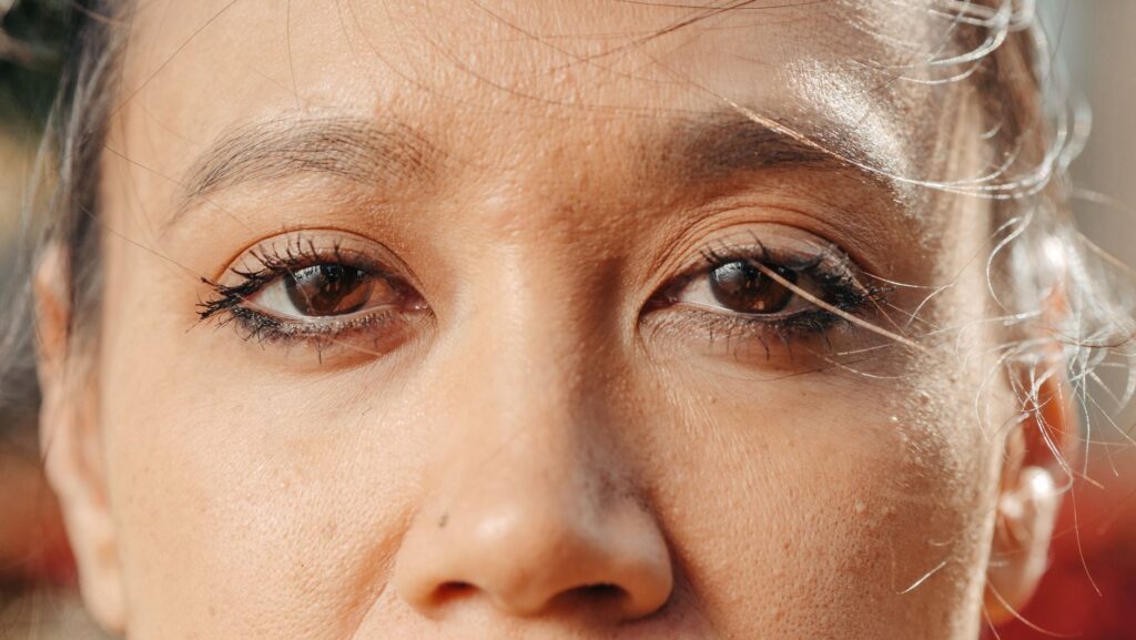 Tear Trough Filler: FDA Approves a New Under-Eye Gel