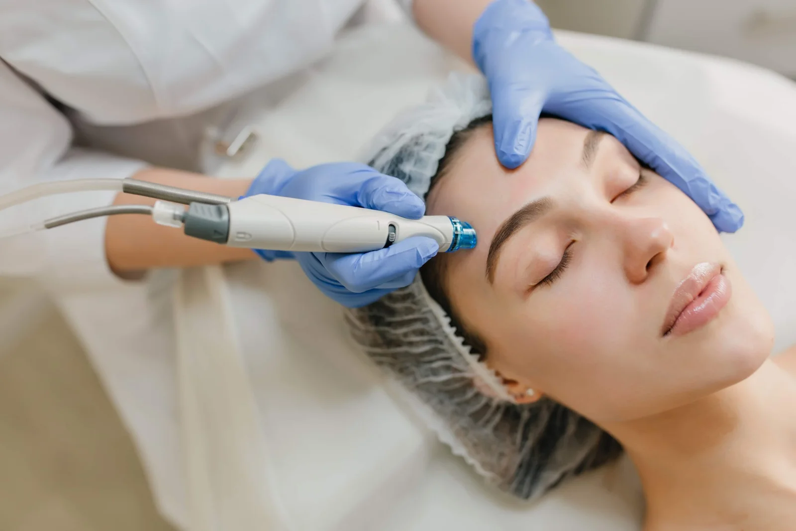Mesotherapy treatment at Dr. Alaa Zidan clinic