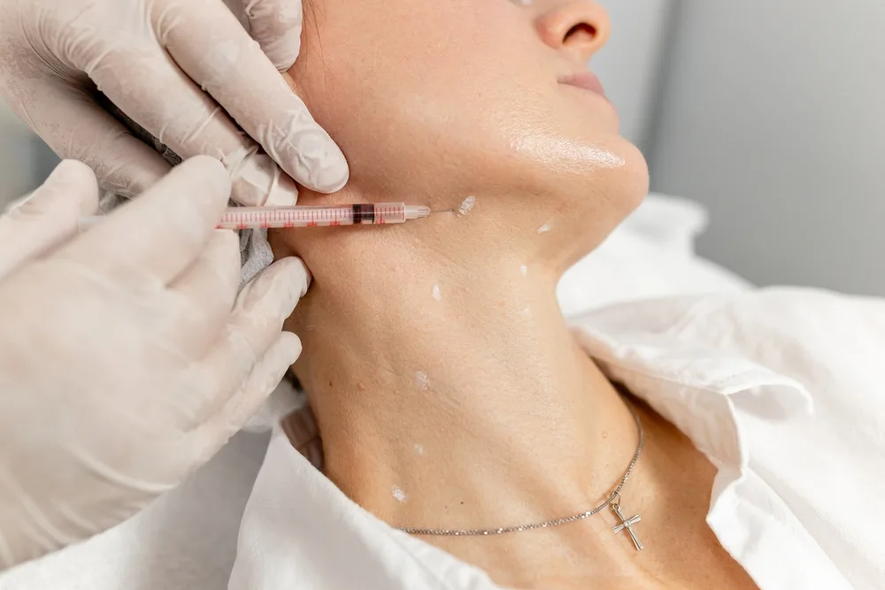 Nefertiti Lift & Neck Contouring treatment at Dr. Alaa Zidan clinic