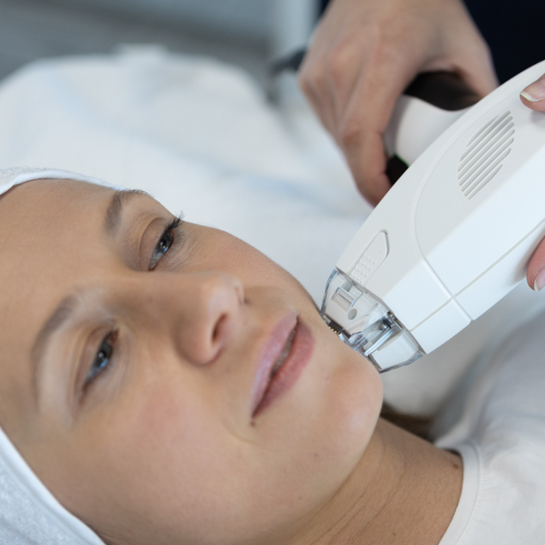 Fractional RF Skin Tightening treatment at Dr. Alaa Zidan clinic