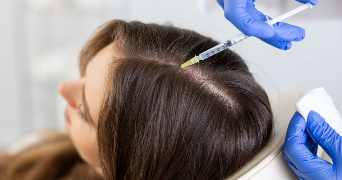 Hair & Scalp Restoration treatment at Dr. Alaa Zidan clinic