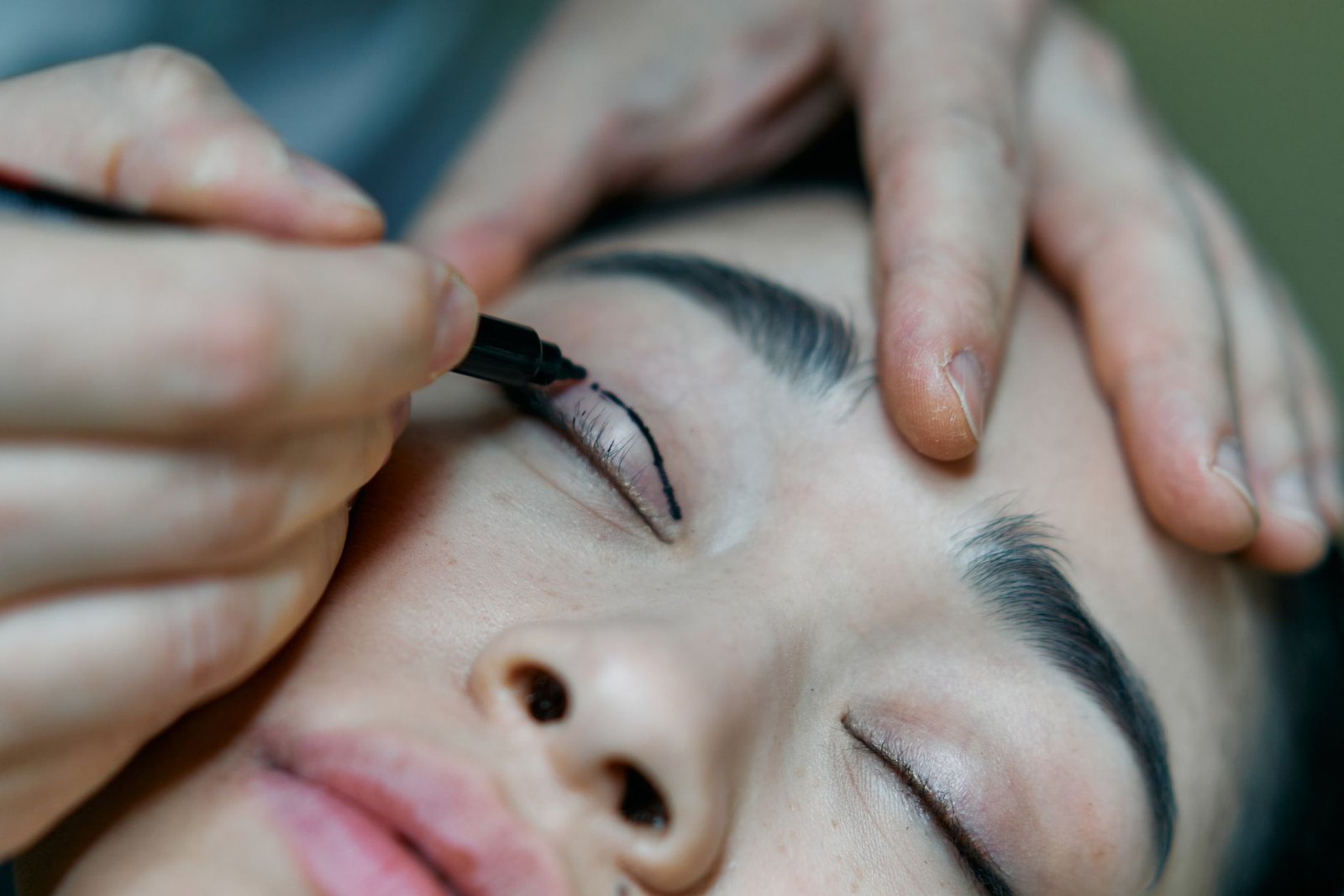 Crow's feet treatment in the Maldives: precise care around the eye area at a Hulhumalé clinic