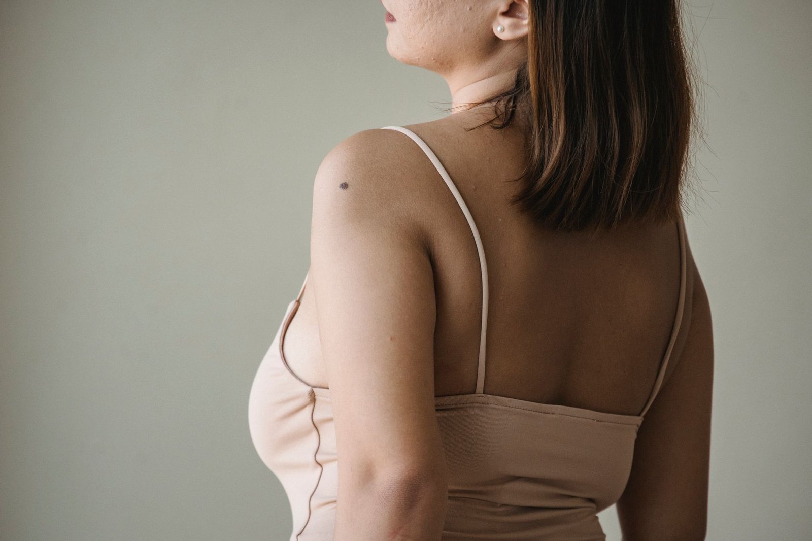 Acne mark treatment consultation for post-inflammatory hyperpigmentation in the Maldives