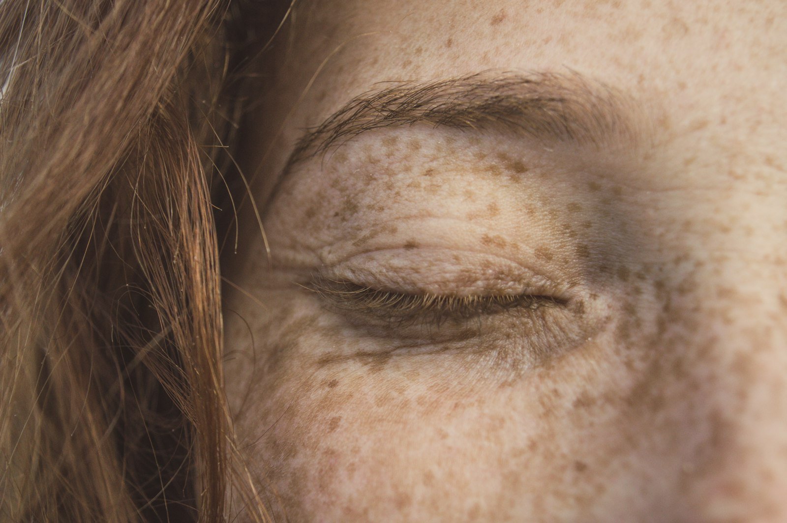 Skin assessment for sun damage treatment in the Maldives
