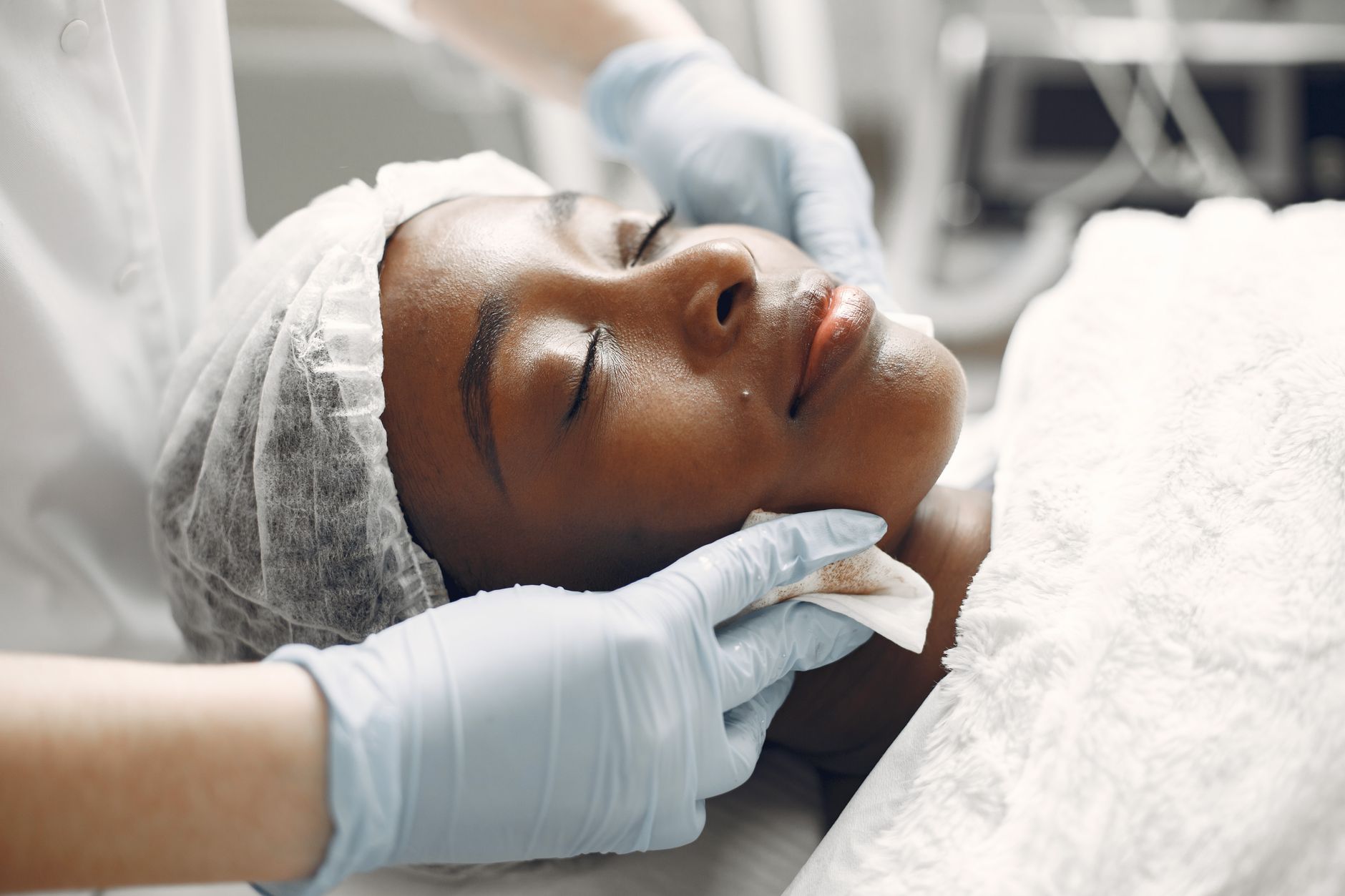Cold Peel treatment in Maldives
