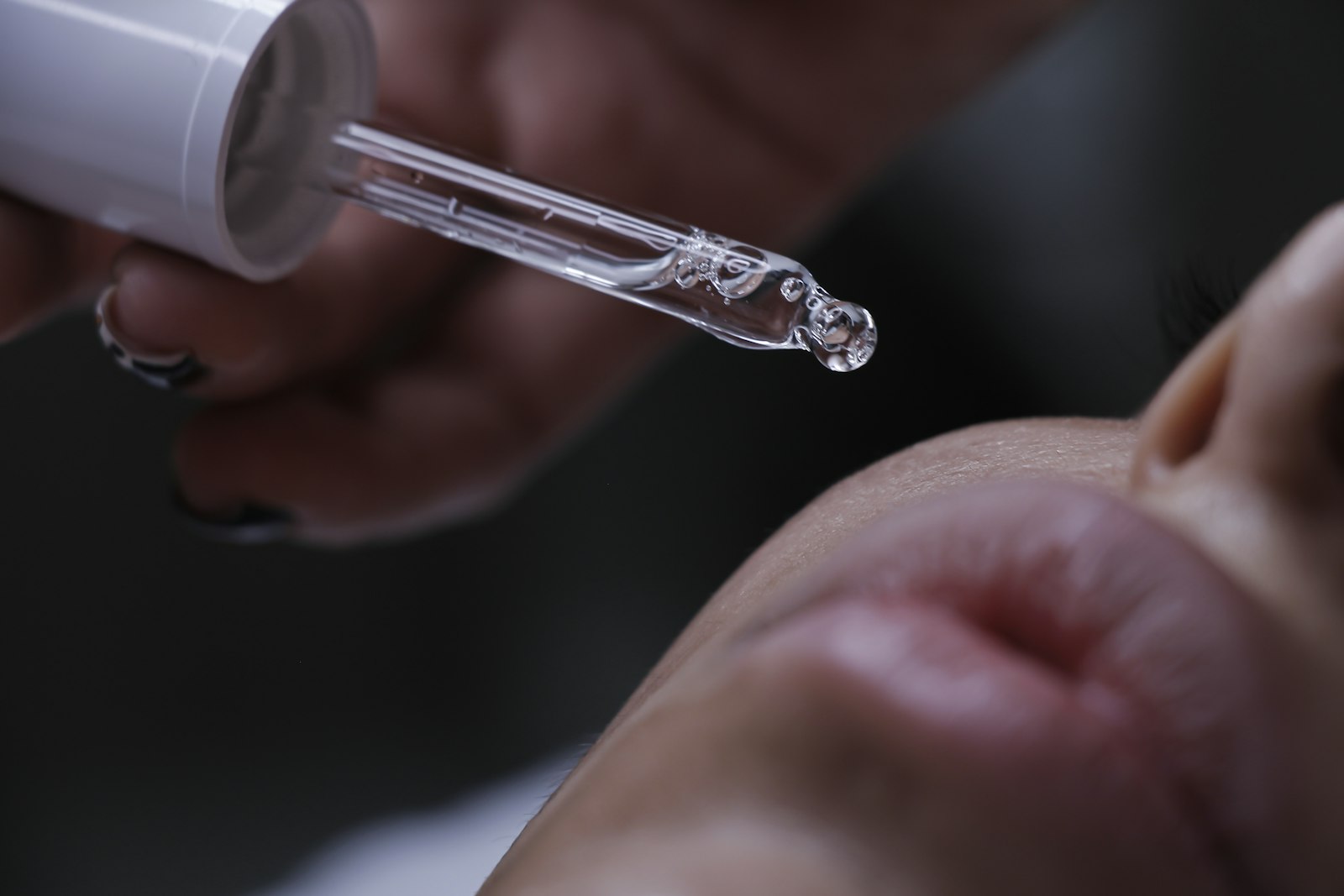 Botox treatment