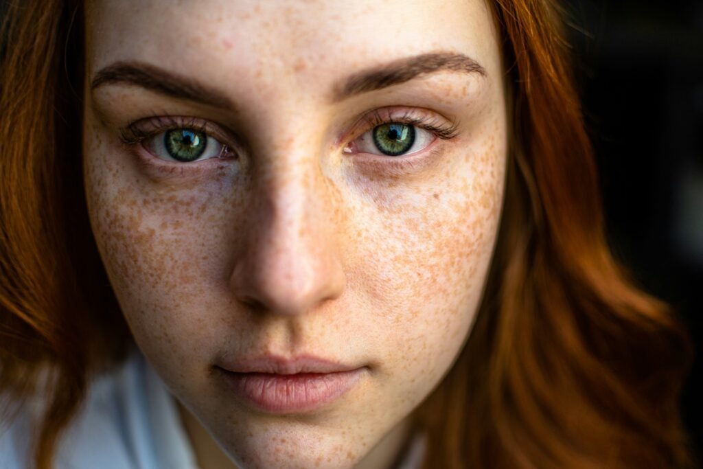 Tranexamic Acid for Melasma: What a New Meta-Analysis Found