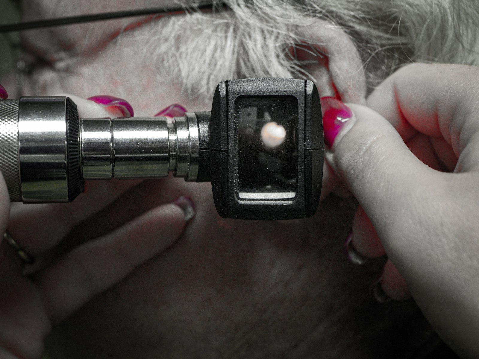 Dermatologist performing a skin check to assess skin cancer risk