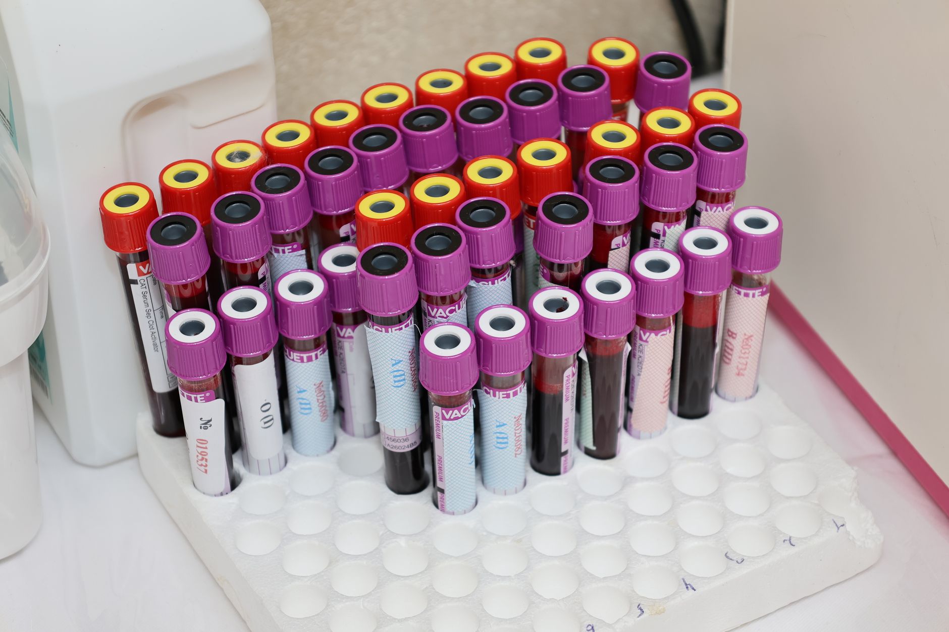 GFC hair treatment Maldives uses growth factors prepared from your own blood sample