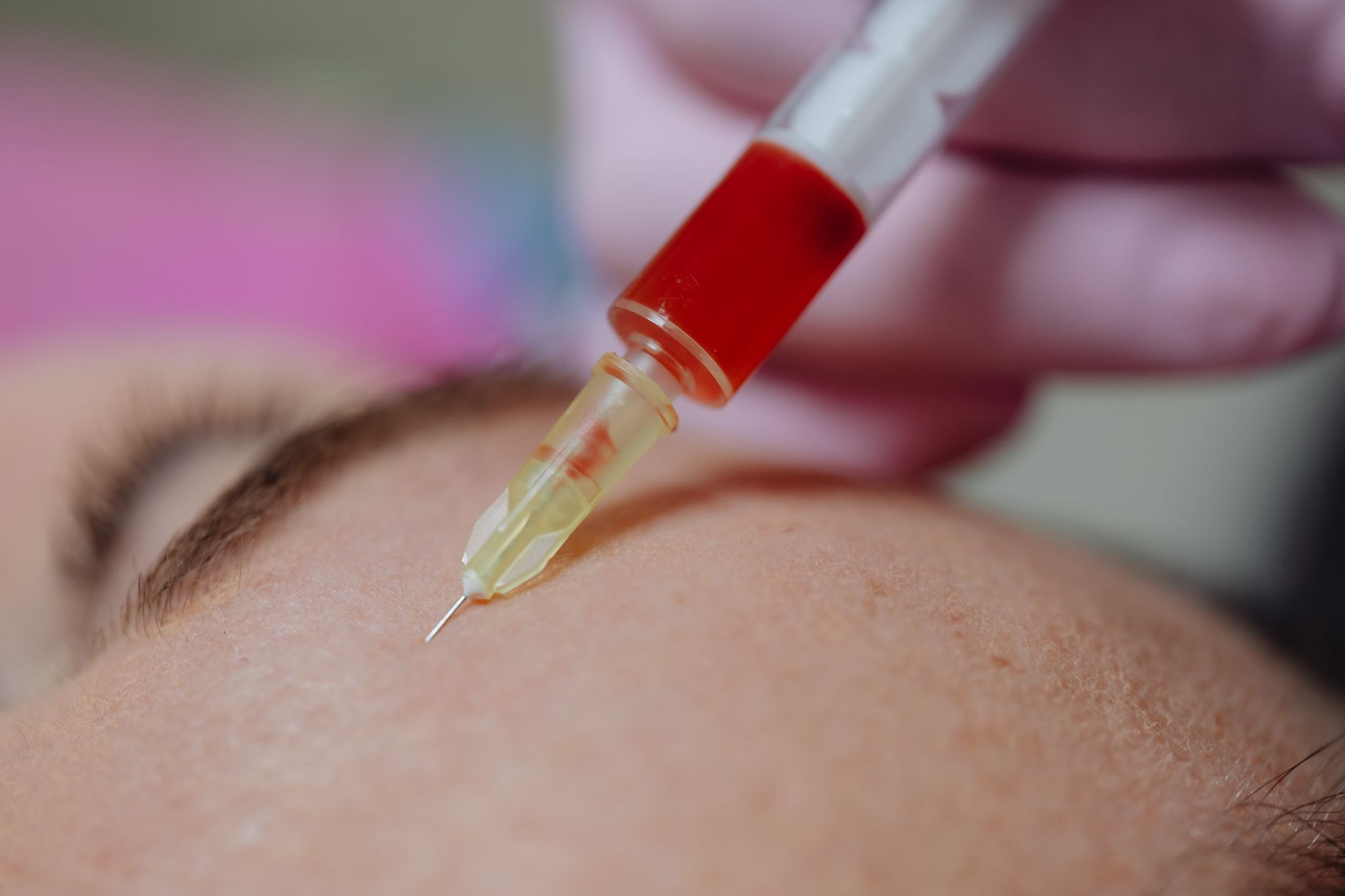Skin boosters vs dermal fillers: both are delivered by fine-needle injection