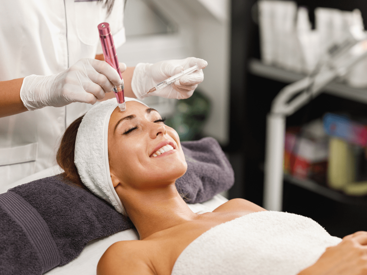 Microneedling with PRP treatment at Dr. Alaa Zidan clinic