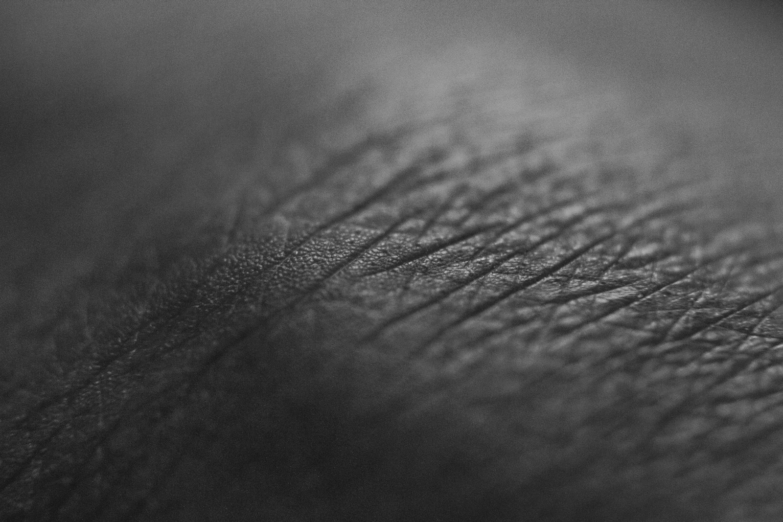 Microneedling mesotherapy Maldives delivers a nourishing blend through microchannels
