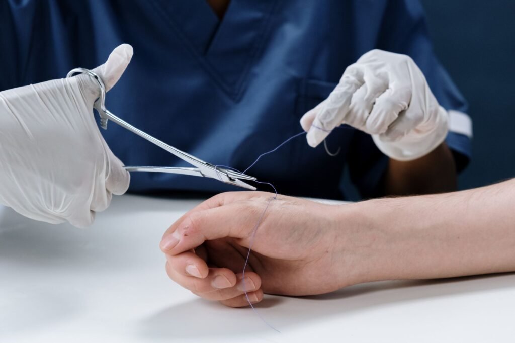 Skin Tag Removal Aftercare: What to Do and Avoid